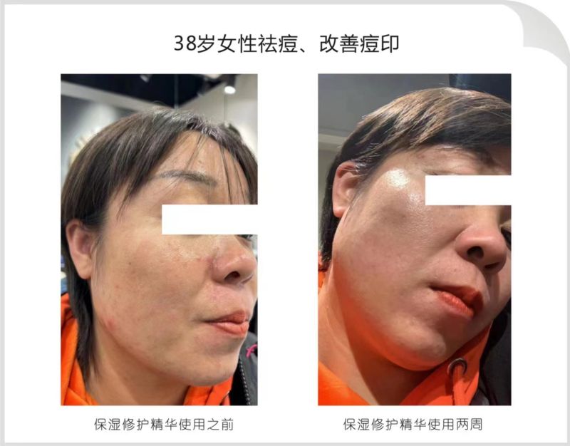 案例展示